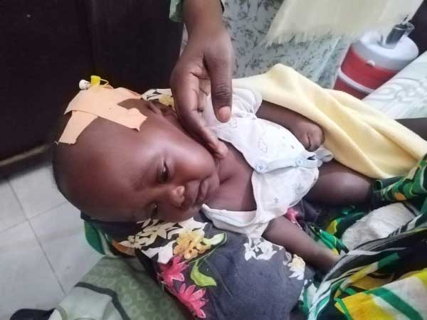 We need to help this kid perform a malignant tumor operation in the skull